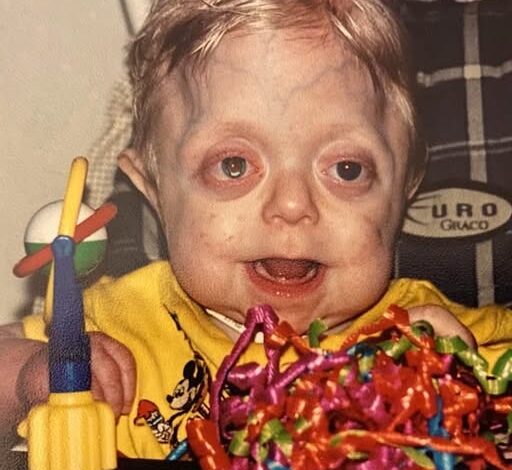 Teen who was not expected to live 18 months graduates high school