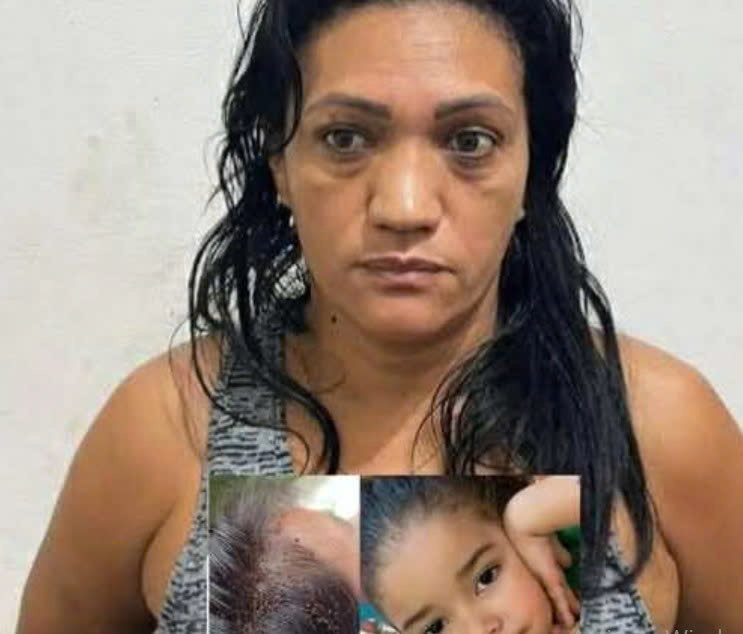 Deadly Lice Infestation Claims Toddler: A Mother’s Urgent Warning to Parents